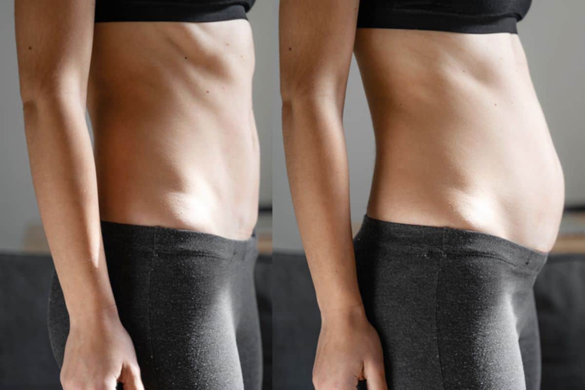 How long does diastasis recti take to improve Greenwich?
