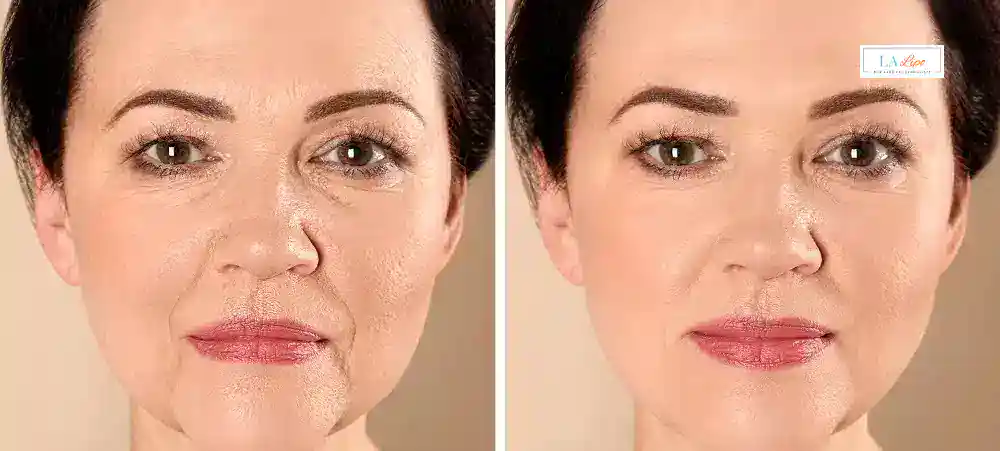Why Aren’t My Skincare Products Making My Sagging Skin Look Firmer Greenwich?